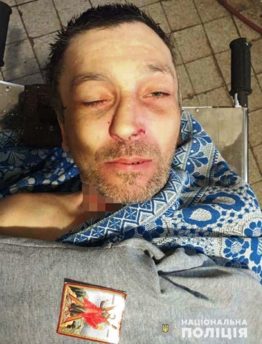 В Ровно мужчина совершил суицид