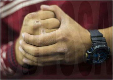 В Одессе подросток жестоко избил сверстника В Одессе подросток жестоко избил сверстника