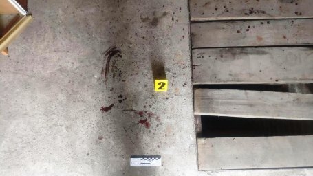 У Дубно літній чоловік побив знайомого молотком