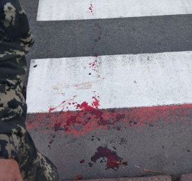 В Чернигове мужчину сбил автомобиль на пешеходном переходе