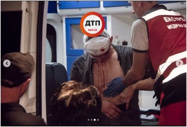 В Киеве мужчина попытался проломить голову сопернику