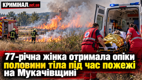 77-річна жінка отримала опіки половини тіла під час пожежі на Мукачівщині 77-річна жінка отримала опіки половини тіла під час пожежі на Мукачівщині