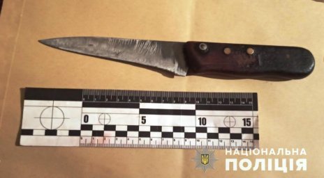 В Арбузинке женщина ударила знакомого ножом