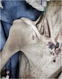 В Днепре в больницу Мечникова сын привез мать заморенную голодом до коматозного состояния