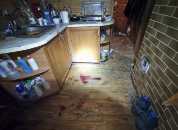 В Житомирской области в результате взрыва пострадали двое мужчин