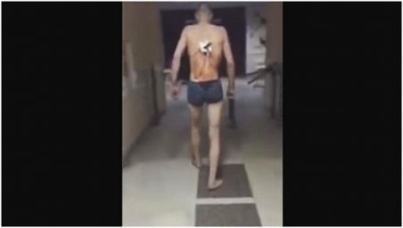 В Татарстане в больницу привезли некромонгера. Появилось видео