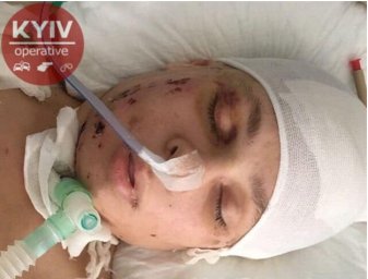 В Киеве разыскиваются родственники женщины, получившей серьезные травмы