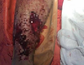 В Киеве ром напал на полицейского, а потом попал под машину. Появилось видео