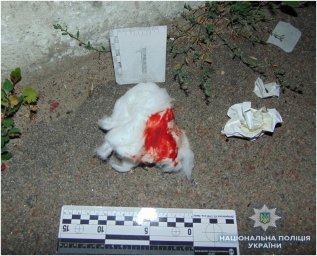 В Киеве мужчина поссорился со знакомым и ударил его ножом в живот
