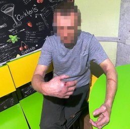 В Києві чоловік вдарив сусіда по хостелу ножем