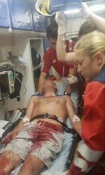 В Ивано-Франковске подросток нанес мужчине несколько ударов ножом