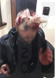 В Одессе мужчина напал с дубинкой на проходившего мимо его дома человека