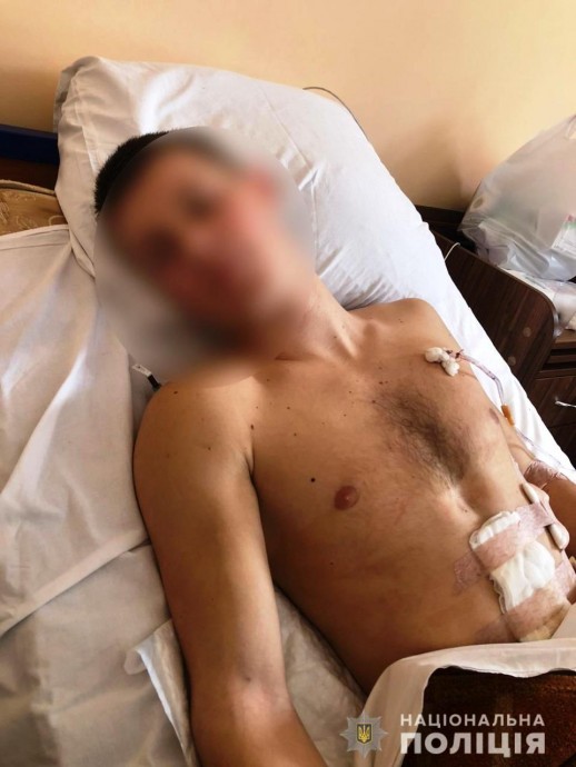 В Вишневом женщина ударила ножом подростка