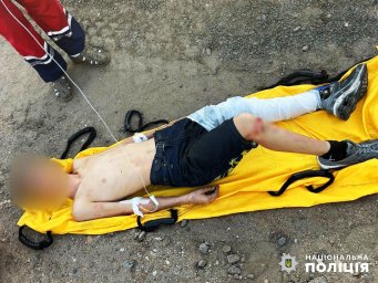 В Одесі на залізниці постраждали двоє підлітків
