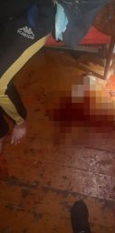 В Днепре мужчина разбил женщине голову, а она ошпарила его кипятком