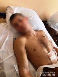 В Вишневом женщина ударила ножом подростка