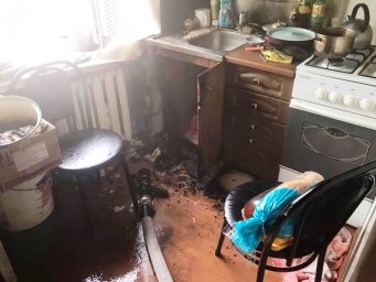 При пожаре в Стрые пострадал мужчина