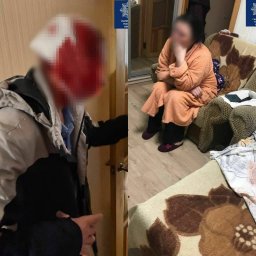 ​Жена разбила голову мужа утюгом