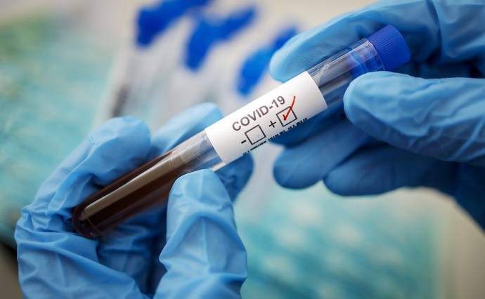 ​Фальшивые тесты на COVID-19 изготавливали на Харьковщине
