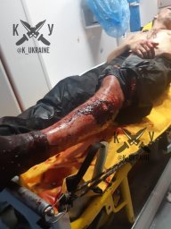 В Харькове ​четверо раненых во время расстрела автобуса, находятся в стабильном состоянии