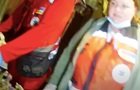​В Киеве задержали мужчину, который бегал голышом, разбил собакой окно и откусил палец хозяину