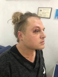 ​В Одессе совершено покушение на главного режиссера Оперного театра
