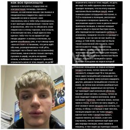 ​В Киеве жестоко избили подростка за накрашенные губы