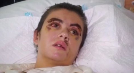 ​На Киевщине фитнес-тренер доводил женщин до суицида