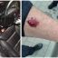 Во Львове пьяный водитель покусал полицейского