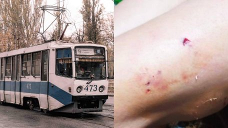 У Кривому Розі чоловік із бультер’єром напав на водійку трамвая