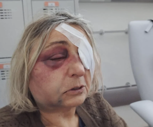 Українця у Польщі арештували за напад на 71-річну жінку