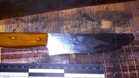 У Франківську під час застілля чоловік ударив знайомого ножем у живіт